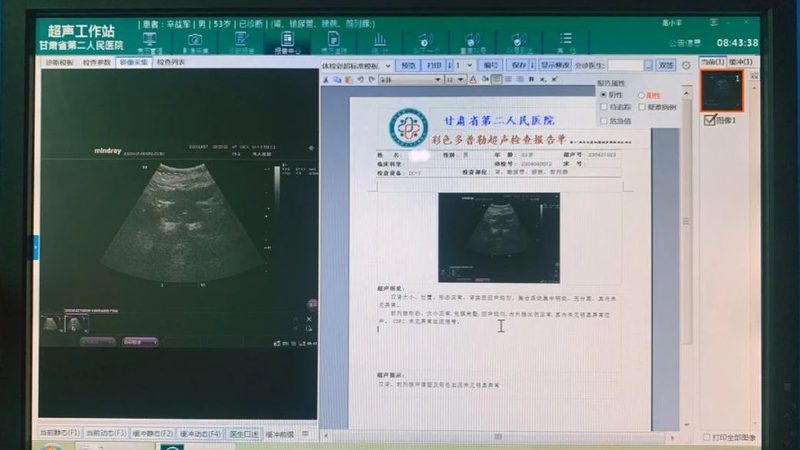 肾病慢病管理标准规范文件：解读与实施要点